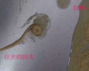 宠物肠道寄生虫的诊断方法