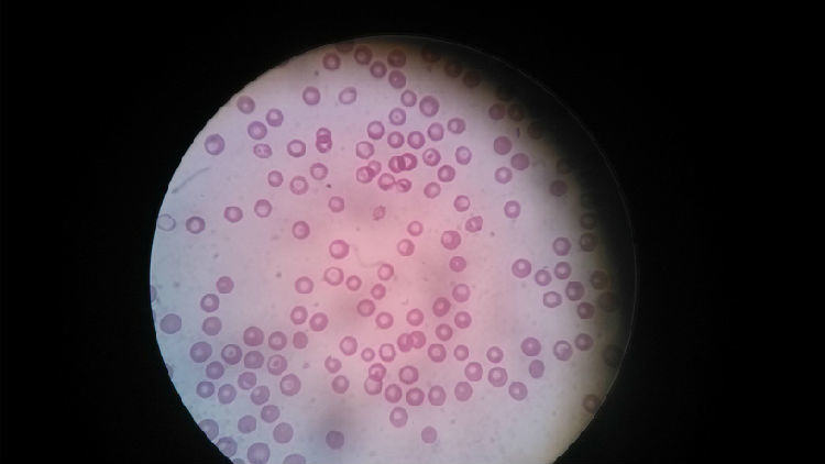 关于宠物贫血的症状及治疗 关于宠物贫血的症状及治疗