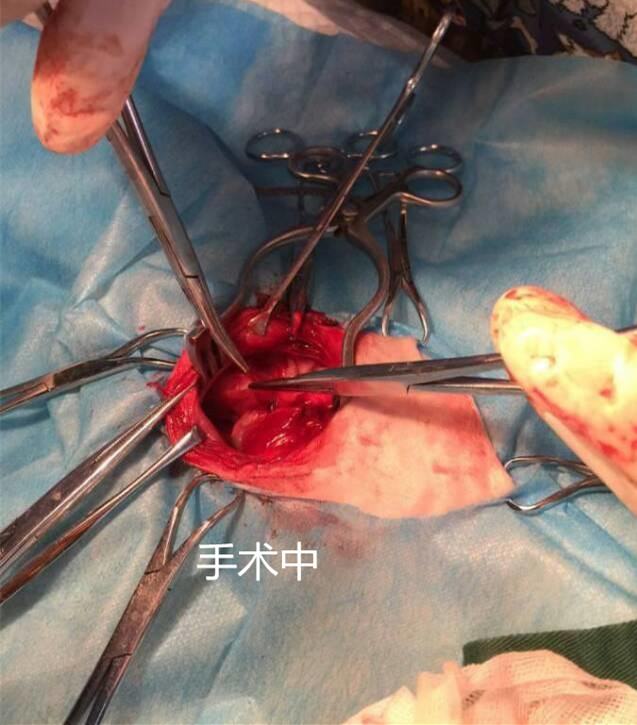 比熊的永久性右位主动脉弓病例分析