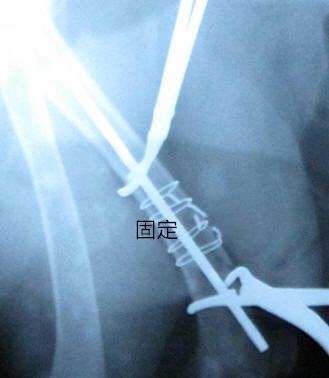 犬的肱骨骨折以及内固定