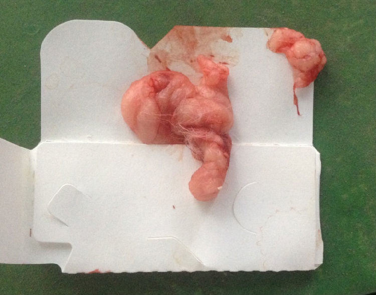 犬脐疝的诊断及手术方法