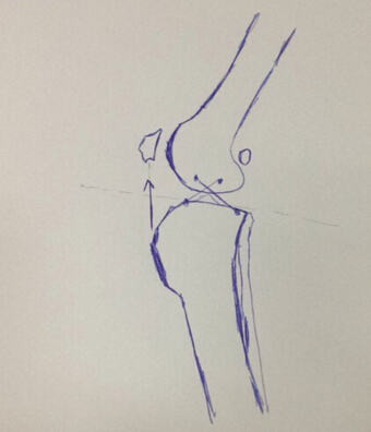 犬后脚跛行，前十字韧带断裂的治疗FAQ