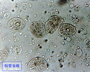 春季淡水鱼类易发的寄生虫病 春季淡水鱼类易发的寄生虫病