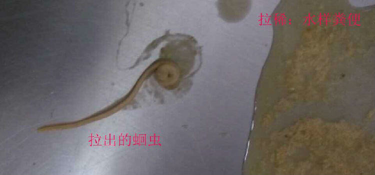 宠物肠道寄生虫的诊断方法 宠物肠道寄生虫的诊断方法