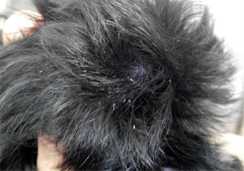 夏季寄生虫之——跳蚤 夏季寄生虫之——跳蚤