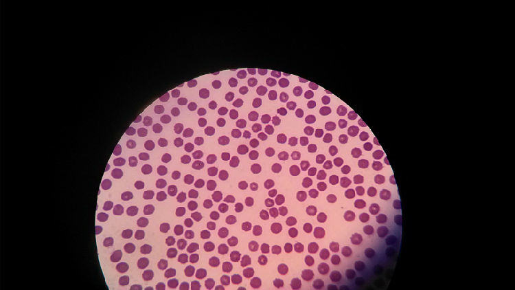 关于宠物贫血的症状及治疗 关于宠物贫血的症状及治疗