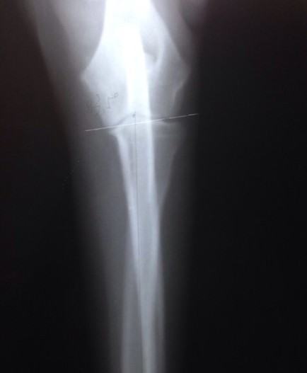 哪个狗的肘关节更好?---犬肘关节发育不良 哪个狗的肘关节更好?---犬肘关节发育不良